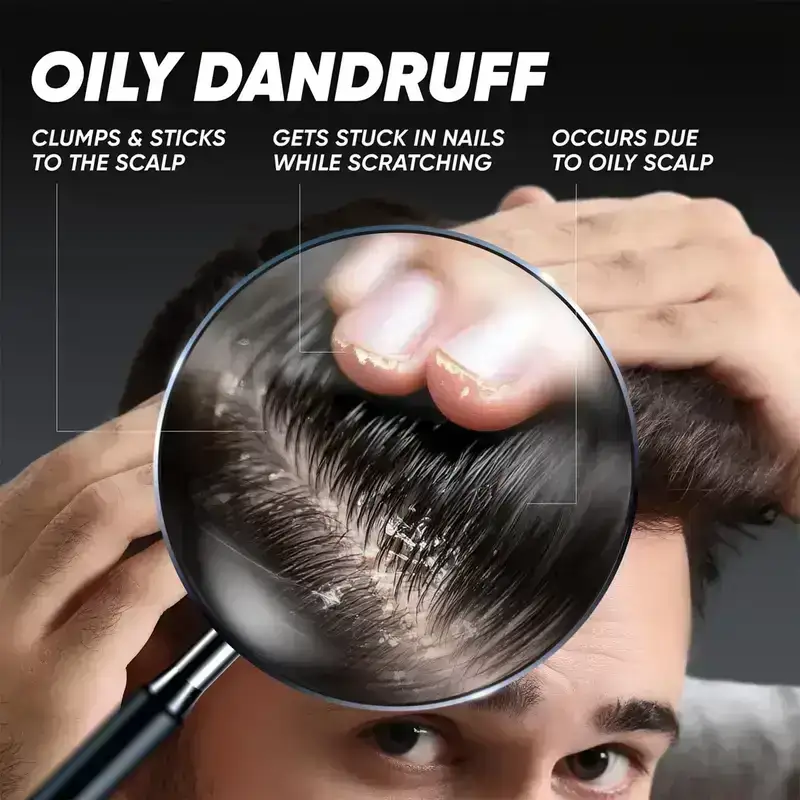 Head & Shoulders Deep Cleanse Anti Dandruff Shampoo, 180ml image 5