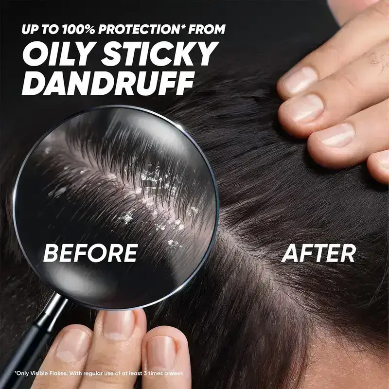 Head & Shoulders Deep Cleanse Anti Dandruff Shampoo, 180ml image 7