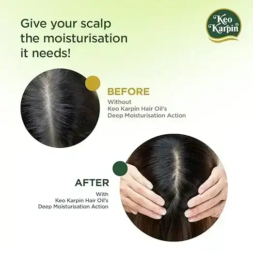 Keo Karpin Hair Oil, 500ml image 2