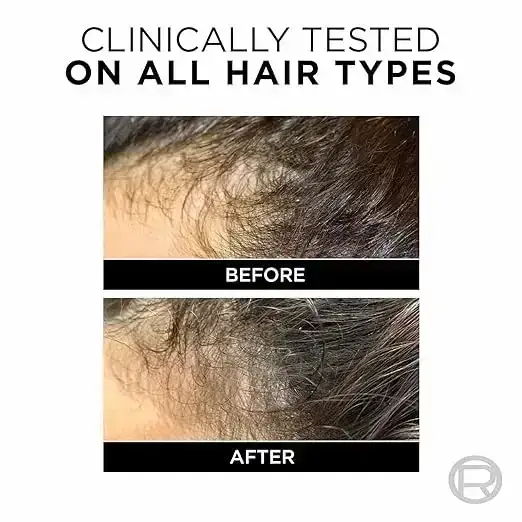 L'Oreal Paris Fall Resist 3X Anti-Hairfall Shampoo, 180ml image 4